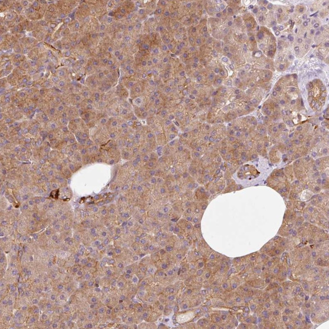 IQGAP2 Antibody in Immunohistochemistry (Paraffin) (IHC (P))