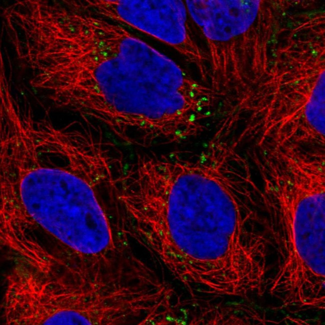 IQGAP2 Antibody in Immunocytochemistry (ICC/IF)