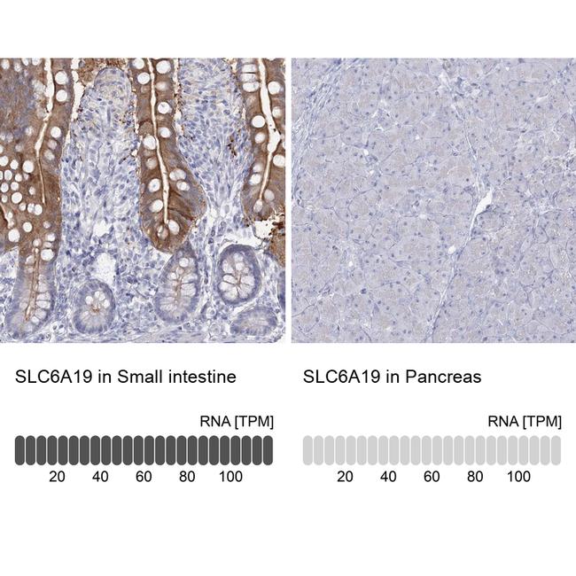 SLC6A19 Antibody in Immunohistochemistry (IHC)