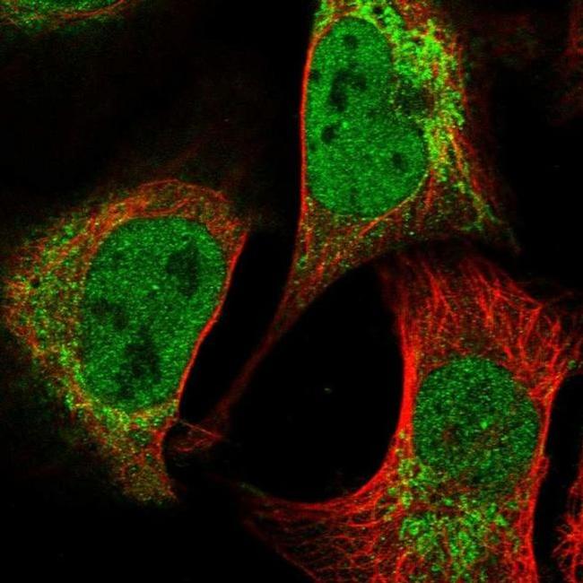 PCYOX1L Antibody in Immunocytochemistry (ICC/IF)