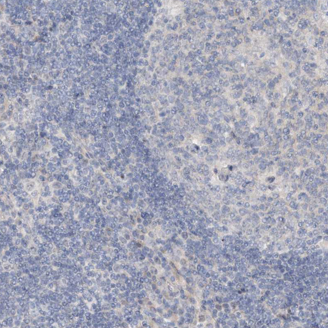 DNAH5 Antibody in Immunohistochemistry (Paraffin) (IHC (P))