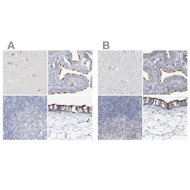 DNAH5 Antibody in Immunohistochemistry (IHC)