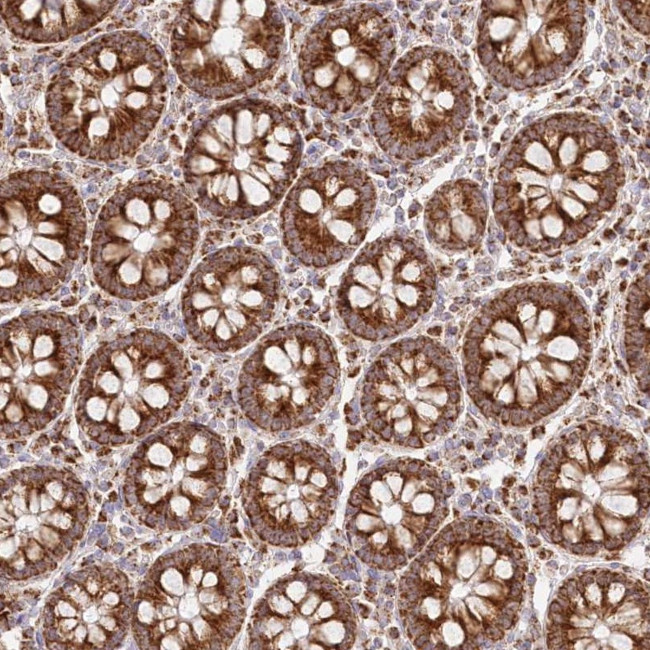 DNA2 Antibody in Immunohistochemistry (Paraffin) (IHC (P))