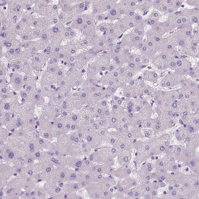 DNAH12 Antibody in Immunohistochemistry (Paraffin) (IHC (P))