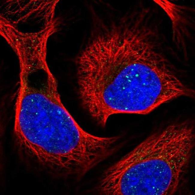 RAP80 Antibody in Immunocytochemistry (ICC/IF)