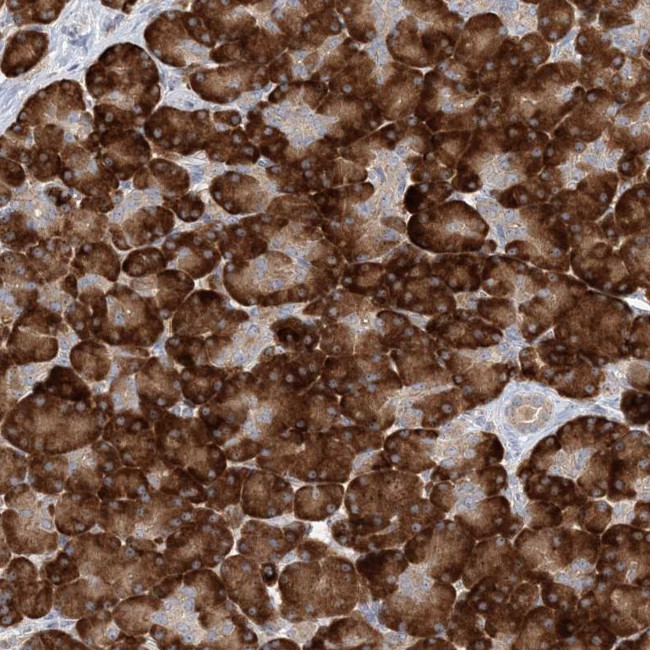 MMADHC Antibody in Immunohistochemistry (Paraffin) (IHC (P))