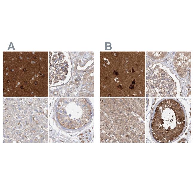 WDR37 Antibody in Immunohistochemistry (IHC)