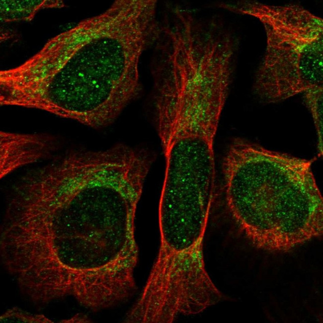 THNSL1 Antibody in Immunocytochemistry (ICC/IF)