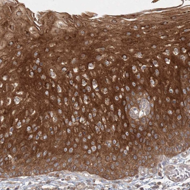 MPP7 Antibody in Immunohistochemistry (Paraffin) (IHC (P))