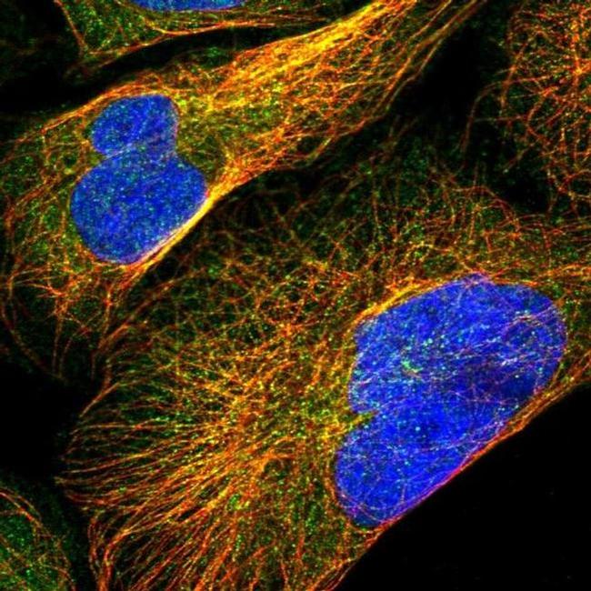 ARHGEF28 Antibody in Immunocytochemistry (ICC/IF)