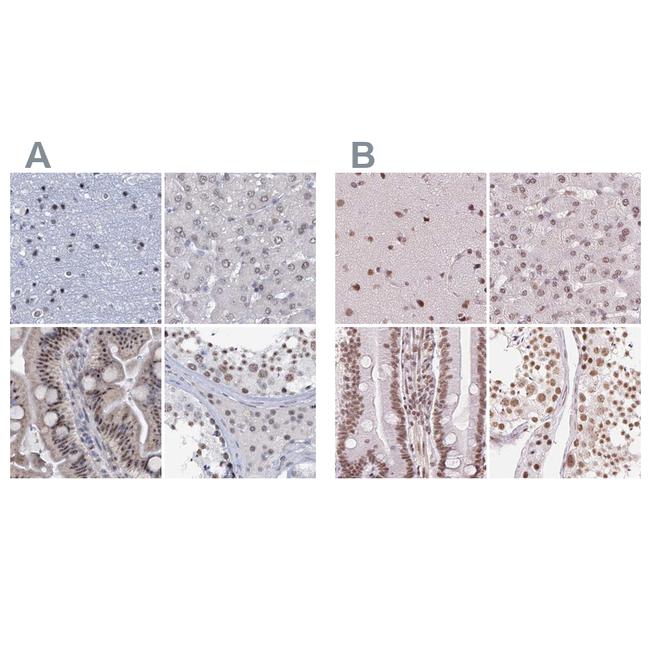 SFRS12 Antibody in Immunohistochemistry (IHC)