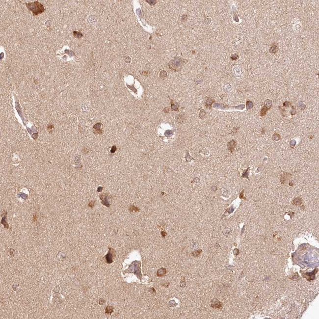 INPP4B Antibody in Immunohistochemistry (Paraffin) (IHC (P))