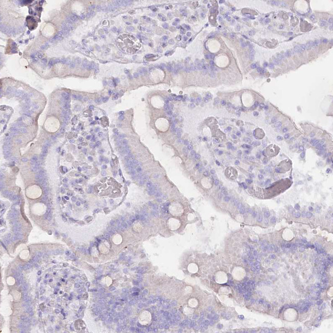 Rbm20 Antibody in Immunohistochemistry (Paraffin) (IHC (P))