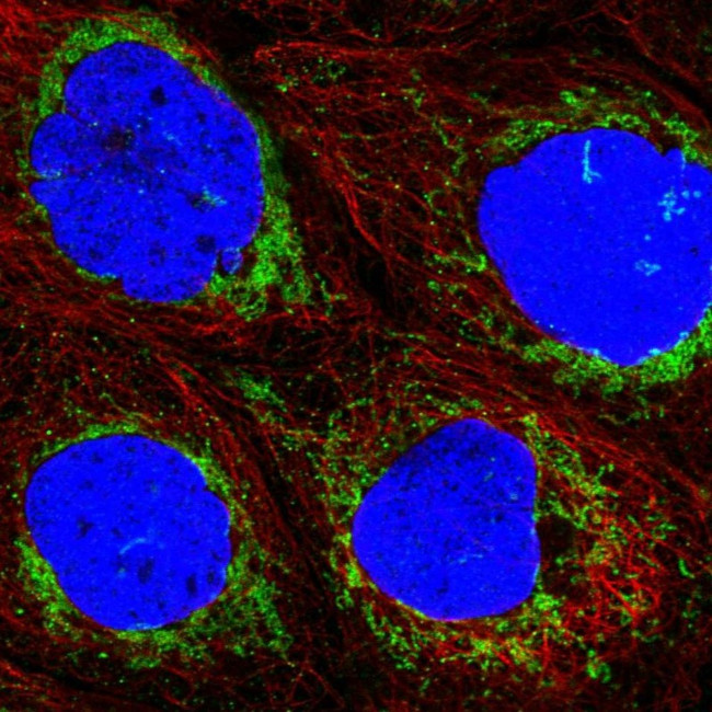 ACAD9 Antibody in Immunocytochemistry (ICC/IF)