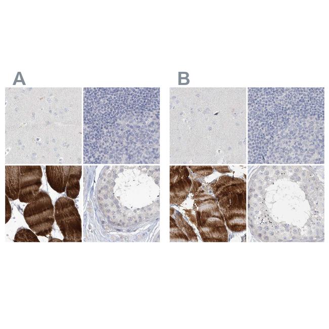 Myotilin Antibody in Immunohistochemistry (IHC)