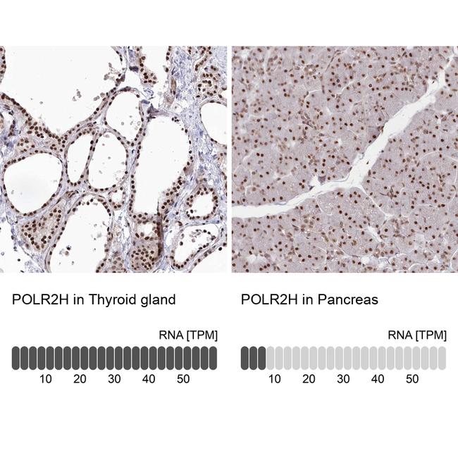 POLR2H Antibody in Immunohistochemistry (IHC)