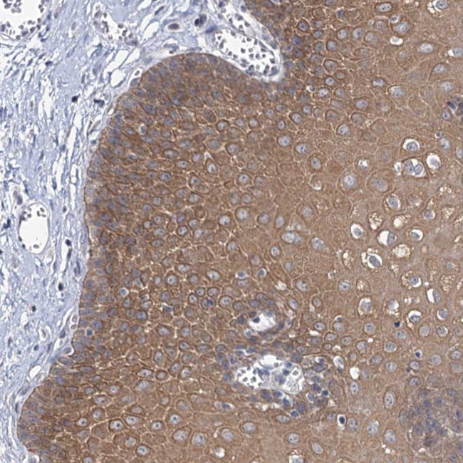 MBLAC2 Antibody in Immunohistochemistry (Paraffin) (IHC (P))