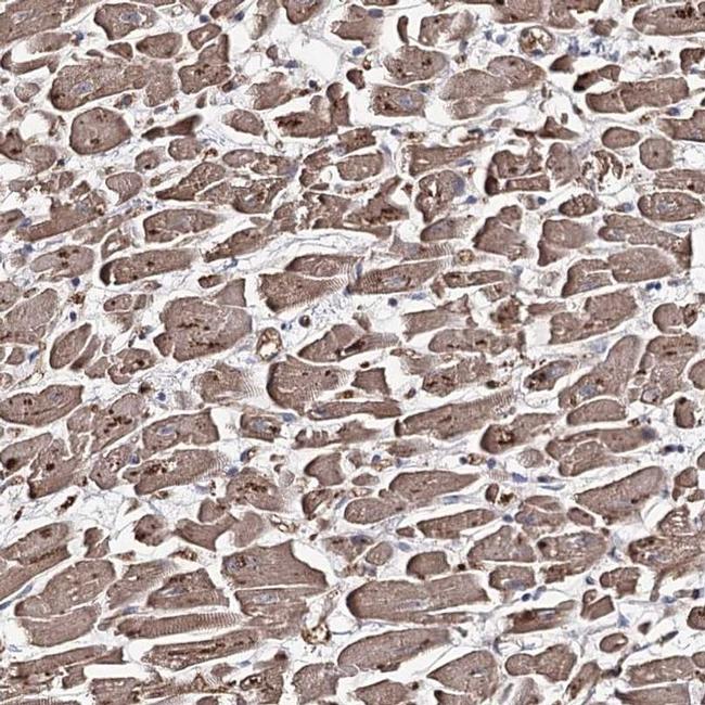 GBF1 Antibody in Immunohistochemistry (IHC)