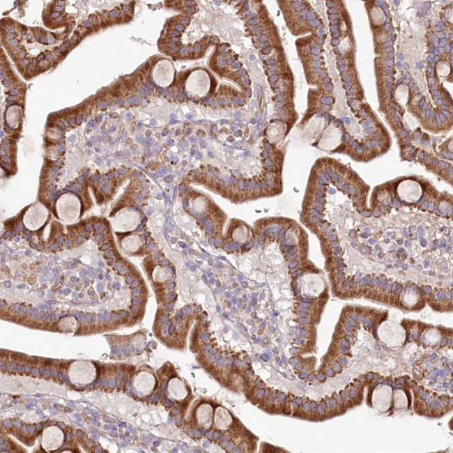 PSTK Antibody in Immunohistochemistry (Paraffin) (IHC (P))