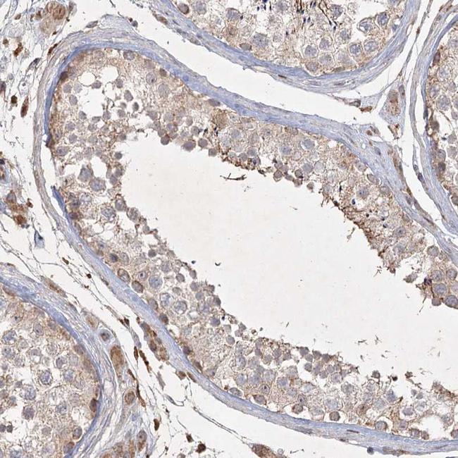 KBTBD4 Antibody in Immunohistochemistry (IHC)