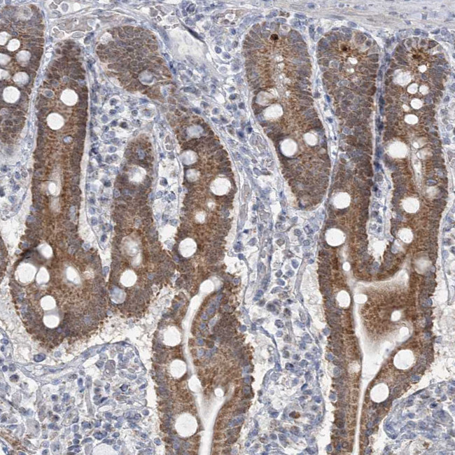 MTG1 Antibody in Immunohistochemistry (Paraffin) (IHC (P))