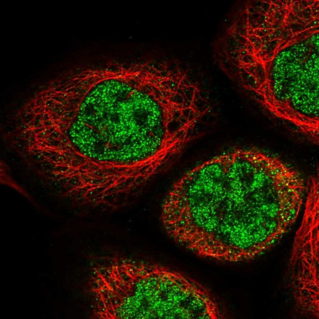 IPMK Antibody in Immunocytochemistry (ICC/IF)