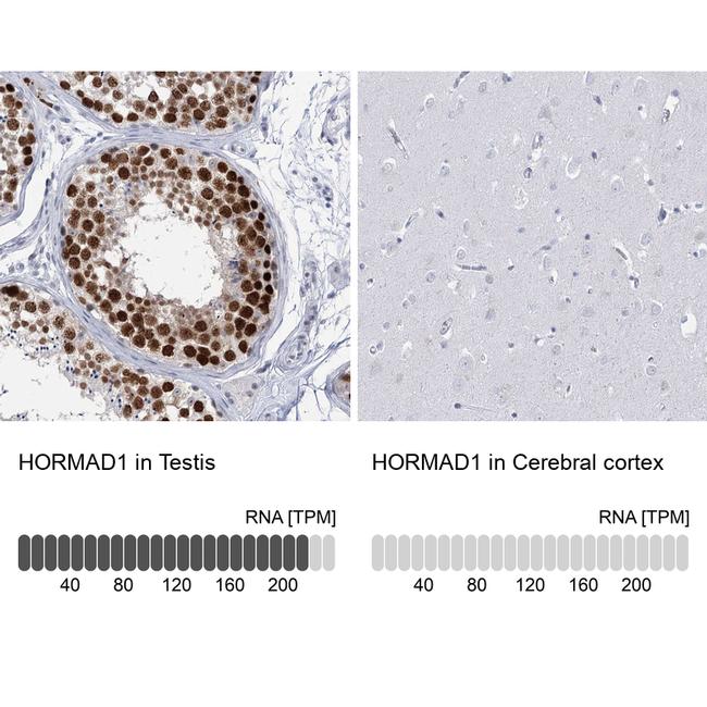 HORMAD1 Antibody in Immunohistochemistry (IHC)