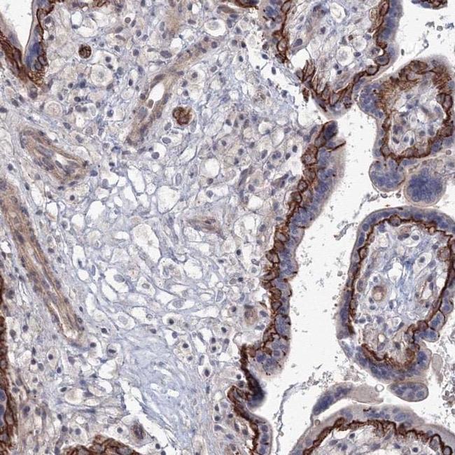 SH3PXD2A Antibody in Immunohistochemistry (IHC)