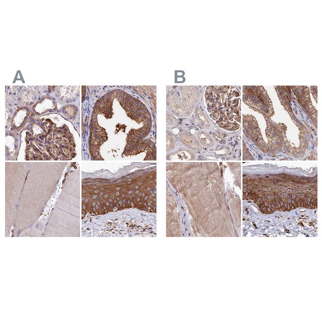 TAB182 Antibody in Immunohistochemistry (IHC)