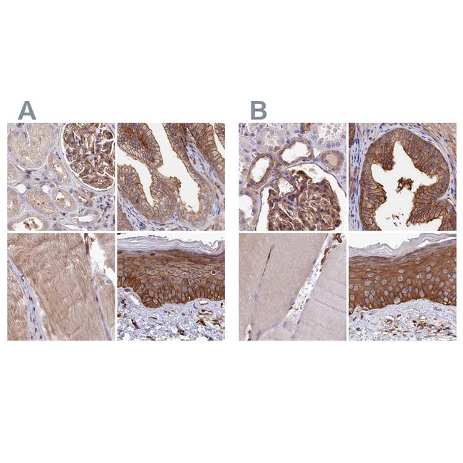 TAB182 Antibody in Immunohistochemistry (IHC)