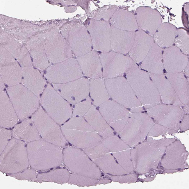 Shootin1 Antibody in Immunohistochemistry (Paraffin) (IHC (P))