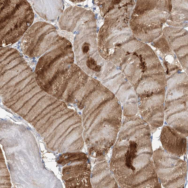 NRAP Antibody in Immunohistochemistry (Paraffin) (IHC (P))