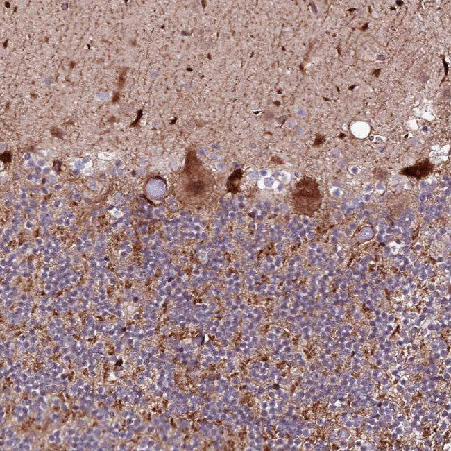 PHLDB1 Antibody in Immunohistochemistry (Paraffin) (IHC (P))