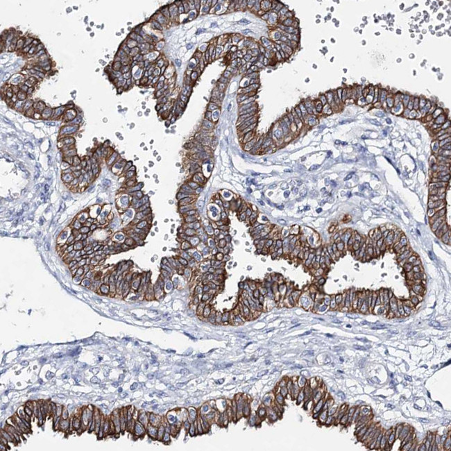 LPHN1 Antibody in Immunohistochemistry (Paraffin) (IHC (P))