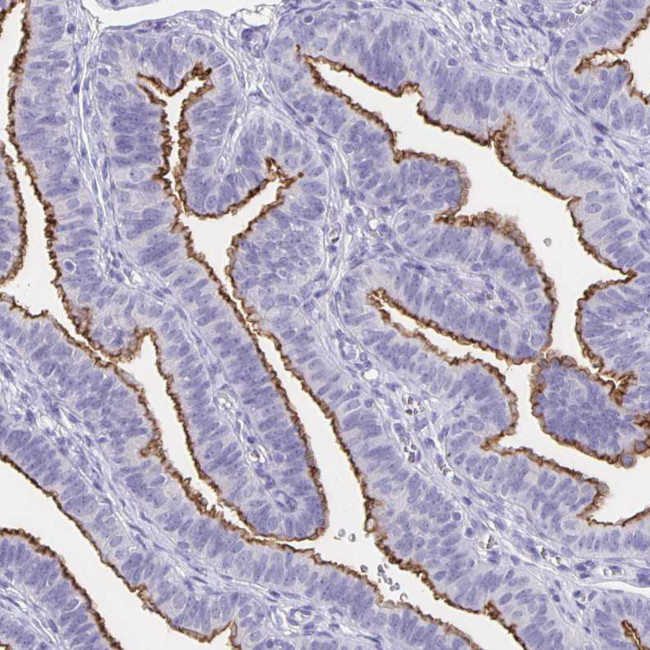 SLC34A2 Antibody in Immunohistochemistry (Paraffin) (IHC (P))