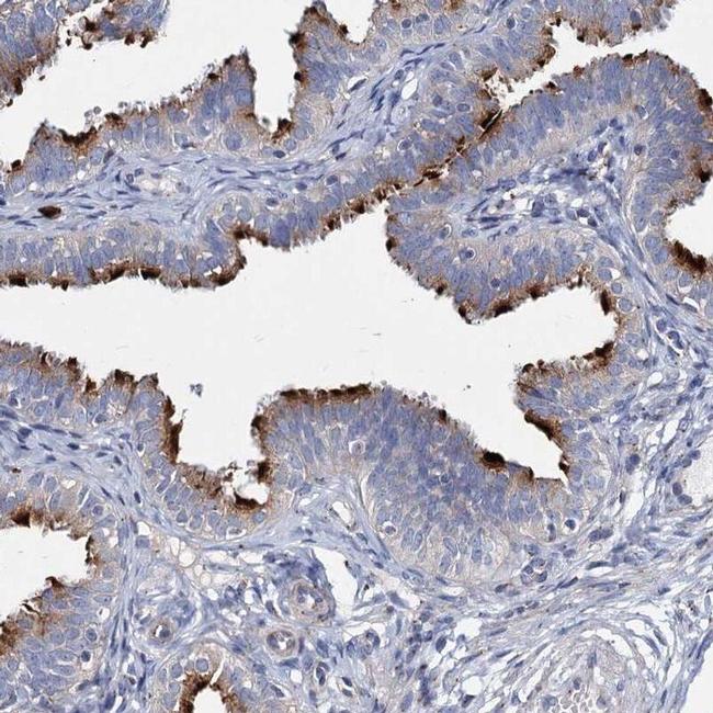 AGBL4 Antibody in Immunohistochemistry (IHC)