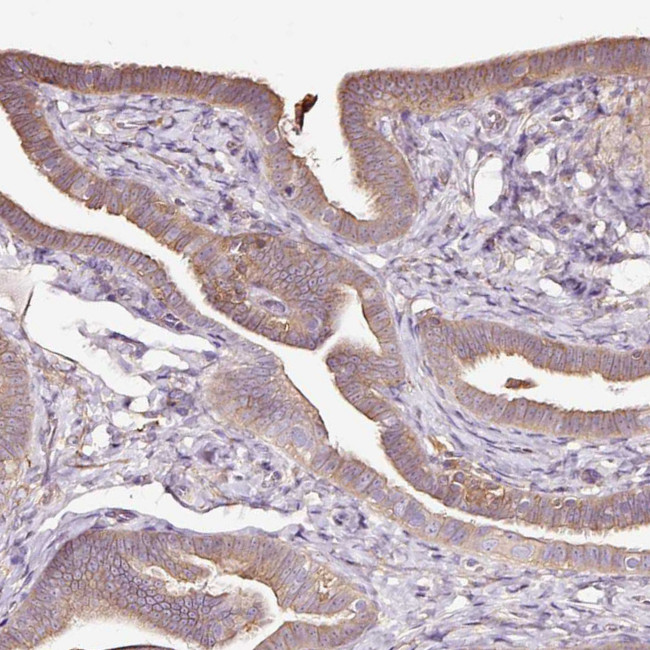 METAP1 Antibody in Immunohistochemistry (Paraffin) (IHC (P))