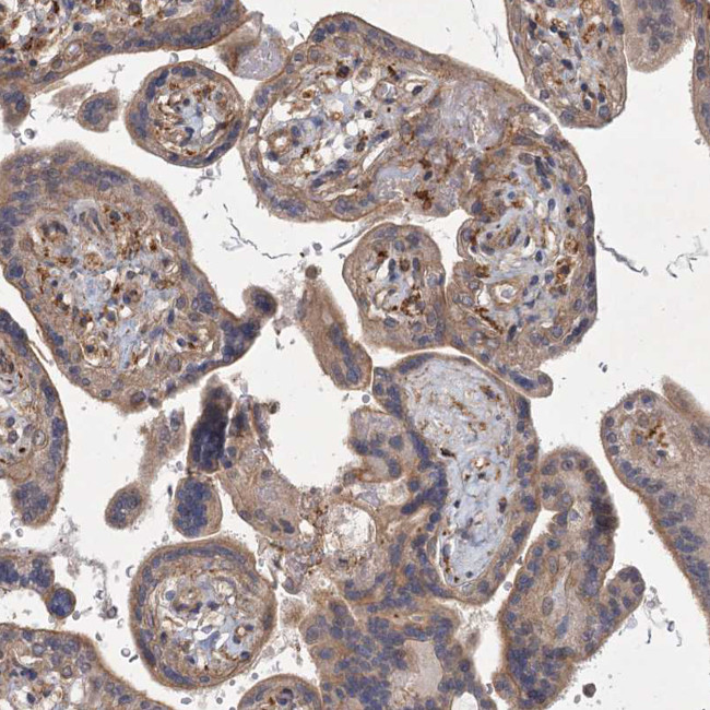 MEPE Antibody in Immunohistochemistry (Paraffin) (IHC (P))