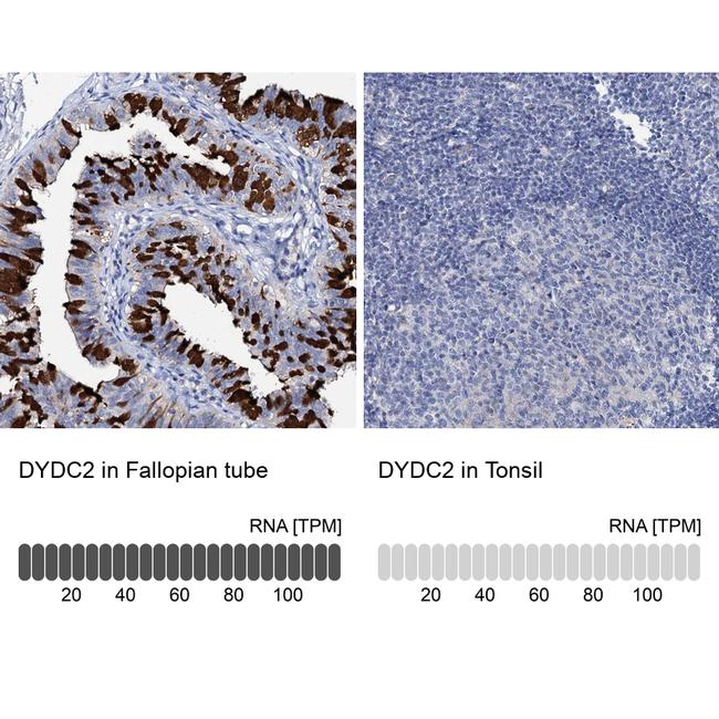 DYDC2 Antibody in Immunohistochemistry (IHC)