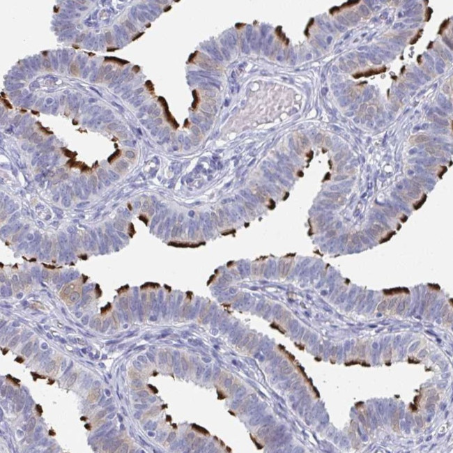 DYDC2 Antibody in Immunohistochemistry (Paraffin) (IHC (P))