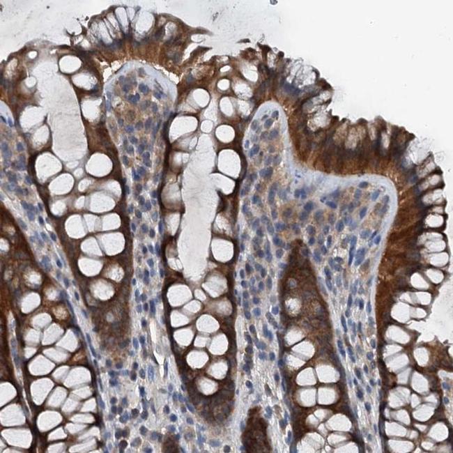 PDSS1 Antibody in Immunohistochemistry (IHC)