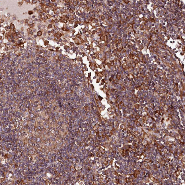 KIF14 Antibody in Immunohistochemistry (Paraffin) (IHC (P))