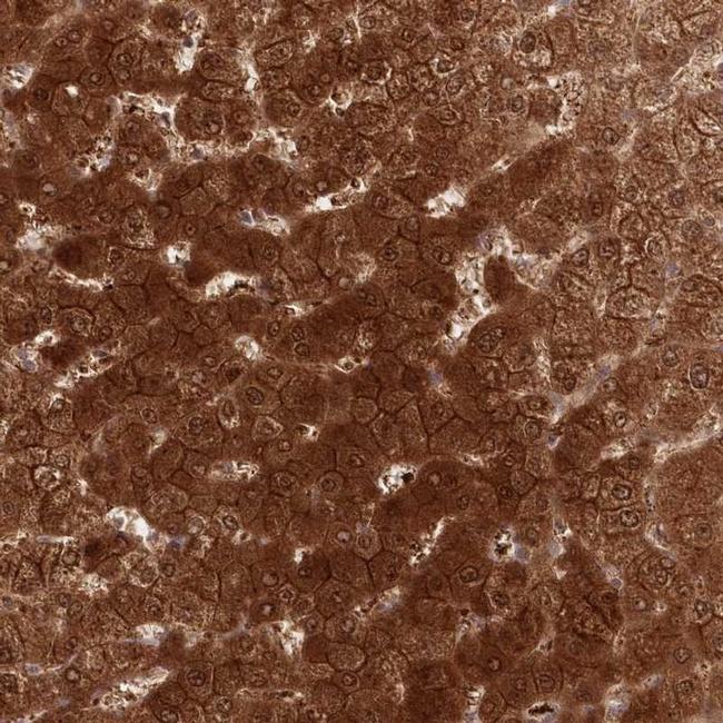 GBE1 Antibody in Immunohistochemistry (IHC)