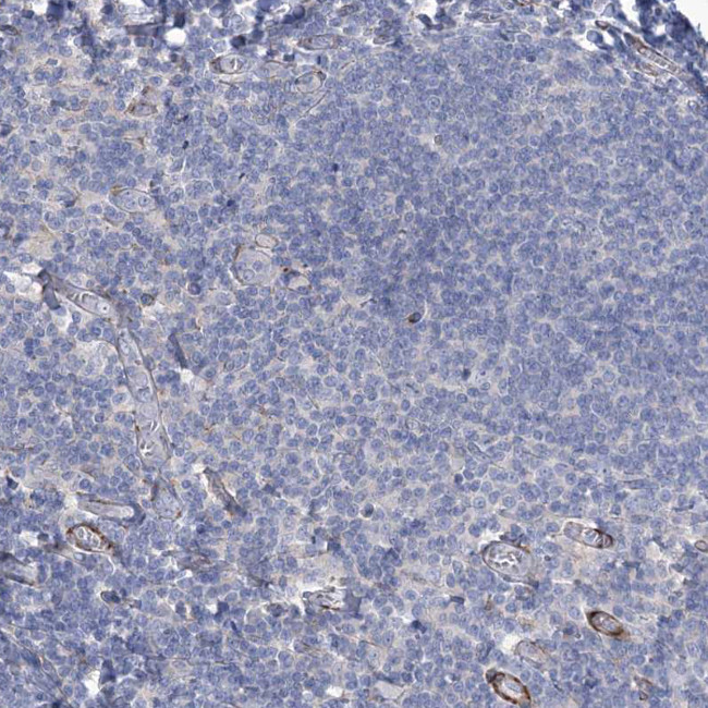 ANGPTL3 Antibody in Immunohistochemistry (Paraffin) (IHC (P))