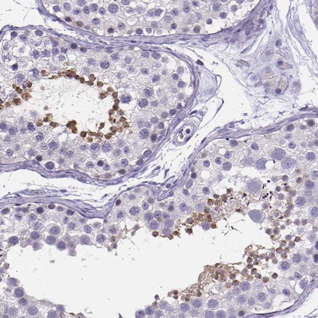 IZUMO1 Antibody in Immunohistochemistry (Paraffin) (IHC (P))