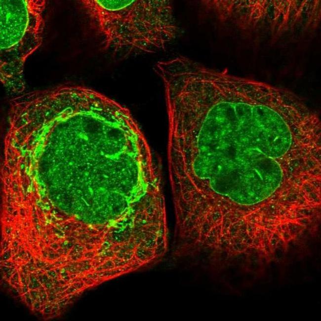 CREB3L4 Antibody in Immunocytochemistry (ICC/IF)