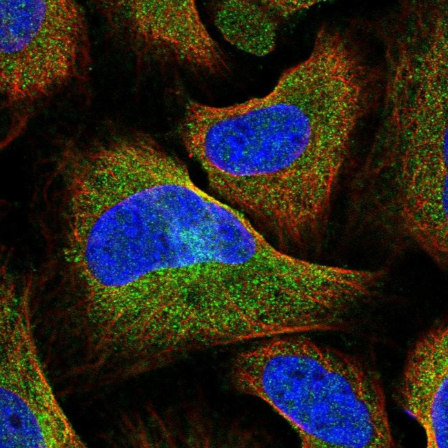 HIP1R Antibody in Immunocytochemistry (ICC/IF)