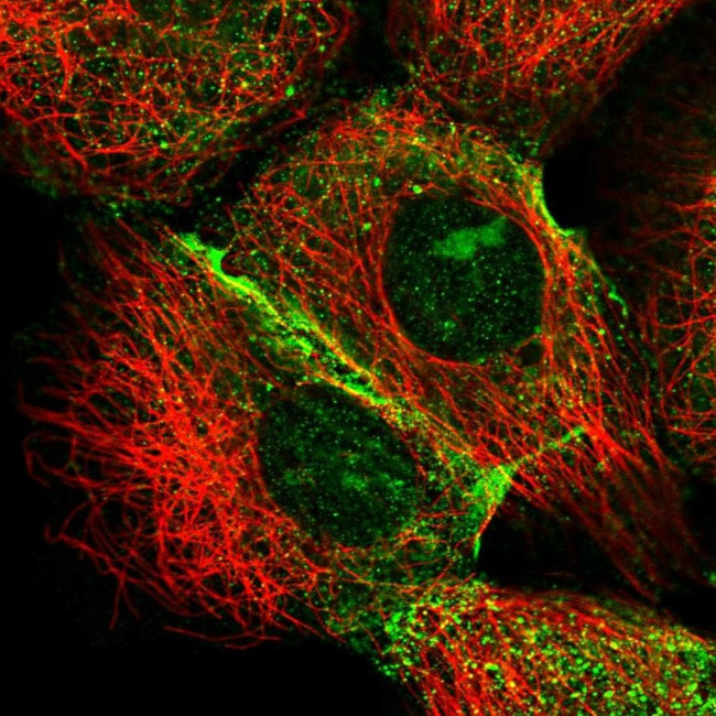 IQSEC1 Antibody in Immunocytochemistry (ICC/IF)