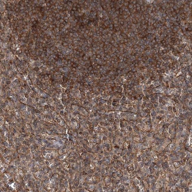 IQSEC1 Antibody in Immunohistochemistry (IHC)