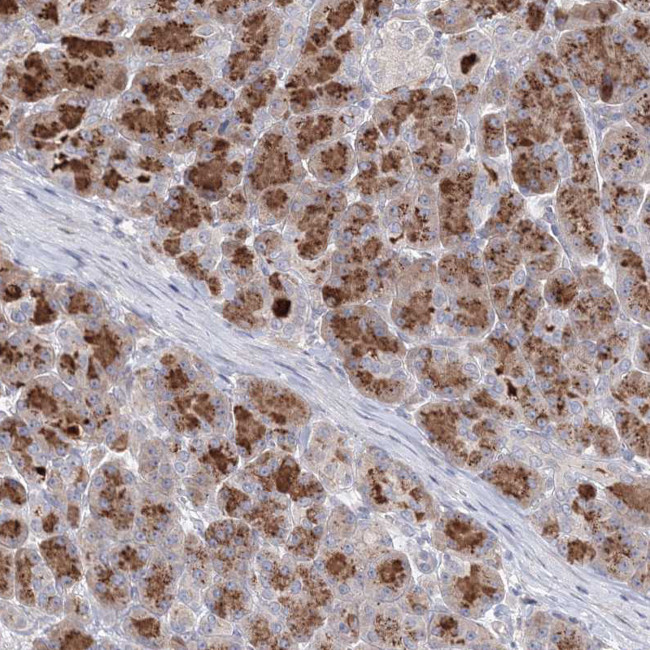 Connexin 31.1 Antibody in Immunohistochemistry (Paraffin) (IHC (P))